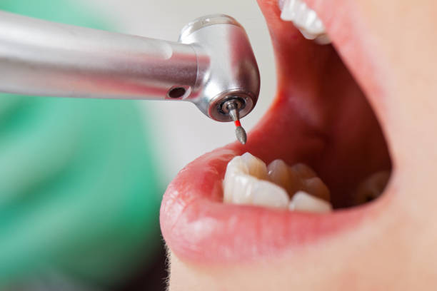 Best Emergency Treatment for Dental Infections or Abscesses in Flora, AL